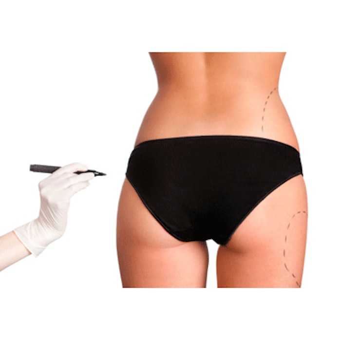 International Cosmetic Procedure Rankings Released