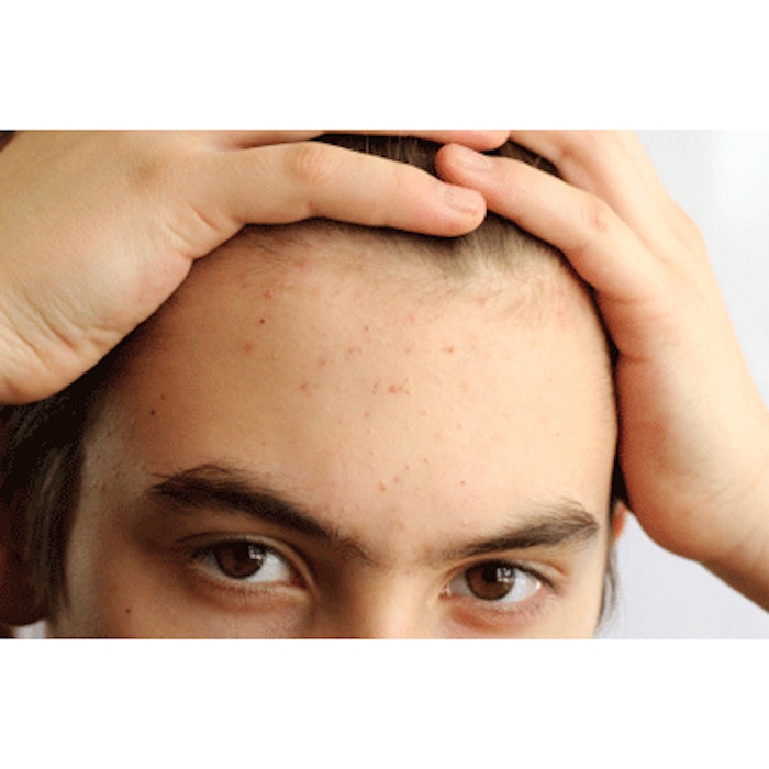 YoDerm Launches, Offering Online Dermatology Consults