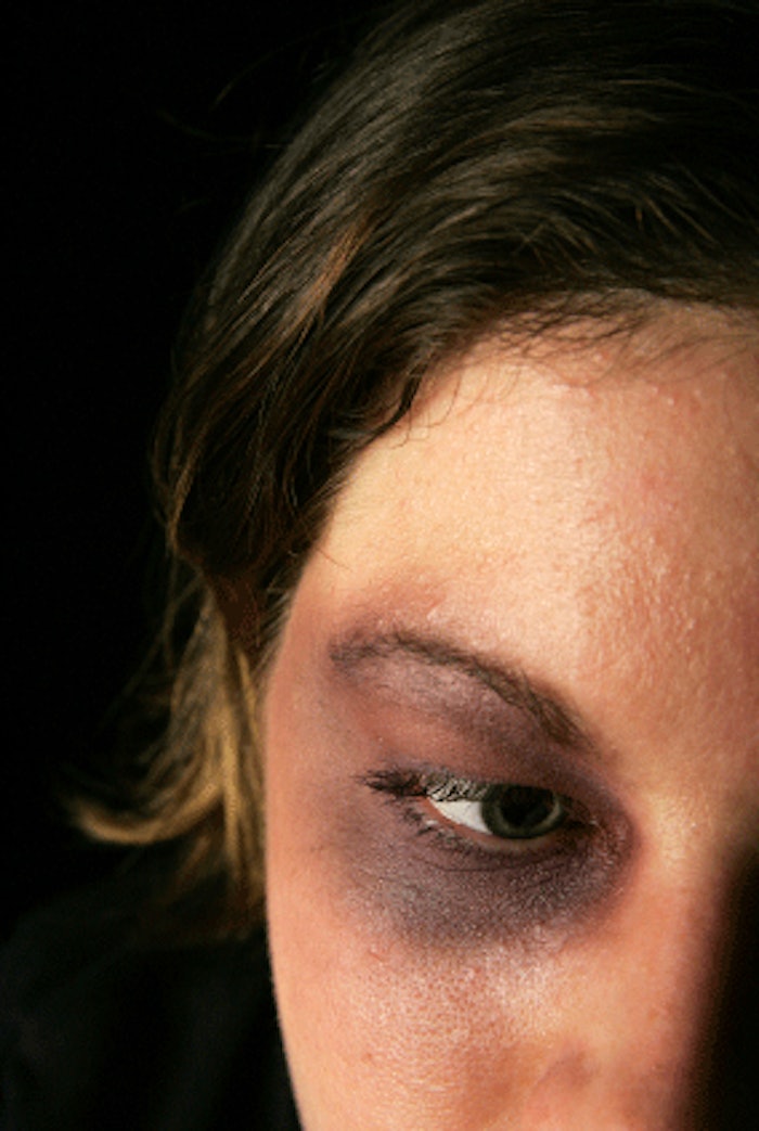 Valeant Pharmaceuticals Announces Partnership With the National Coalition Against Domestic Violence