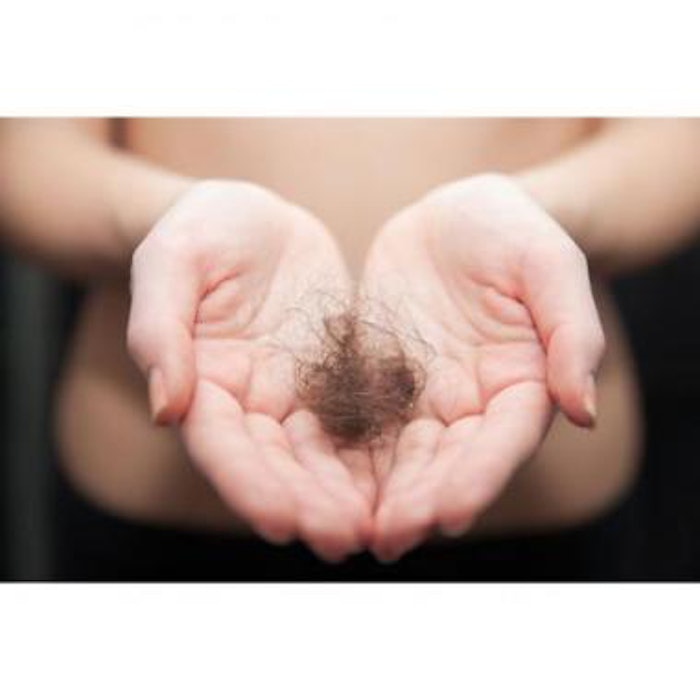 LLLT Improves Hair Growth in Women