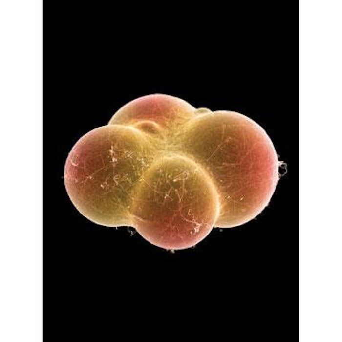Adipocyte Viability Varies Based on Age and Harvesting Site