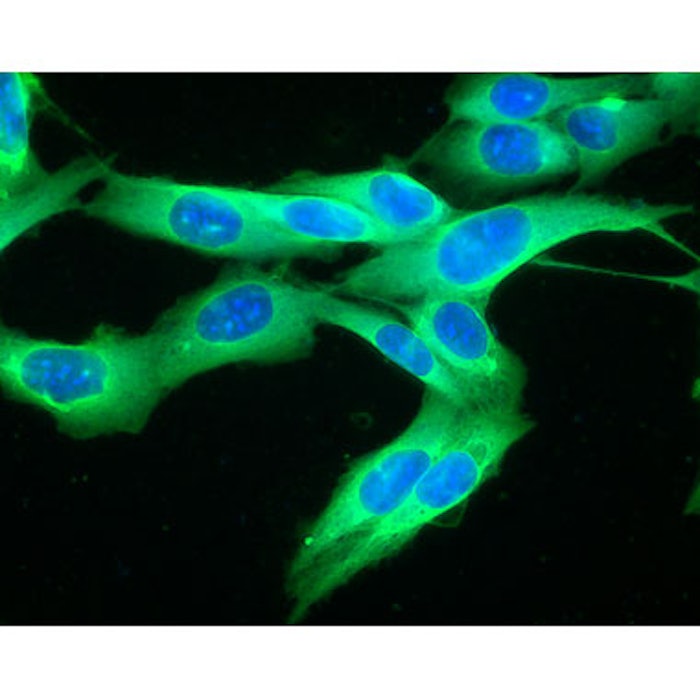 Opdivo Approved for Melanoma