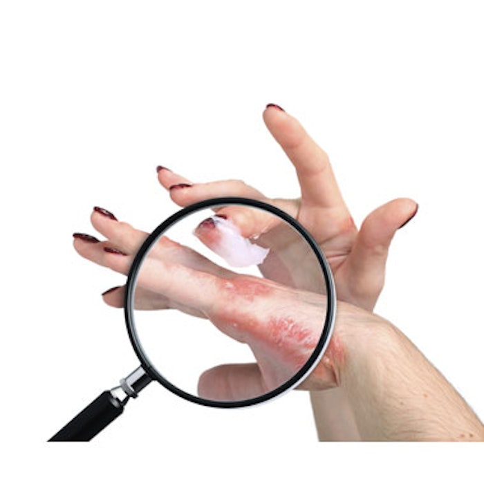 Cipher Acquires Three Astion Dermatology Products