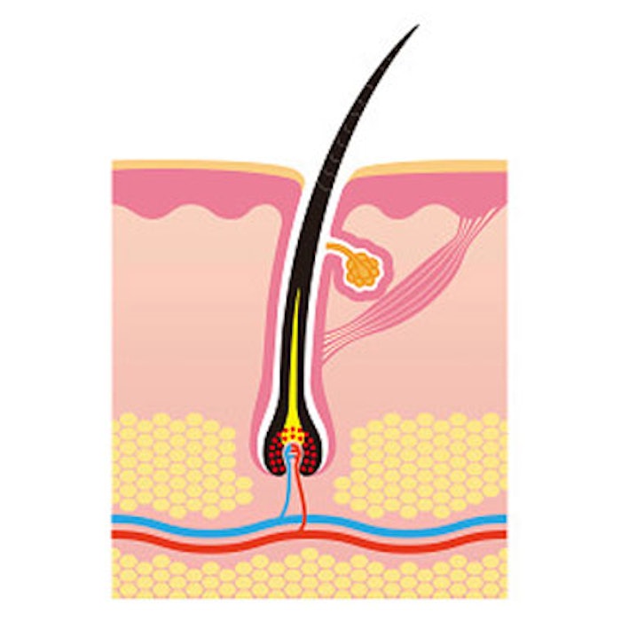 Ablative Fractional Lasers Induce Hair Regrowth