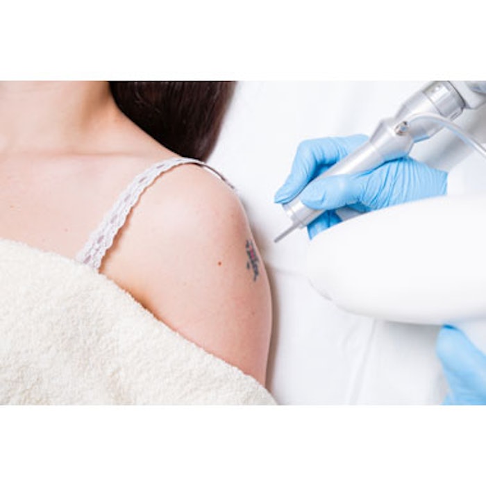 Picosecond Nd:YAG Removes Multicolor Tattoos