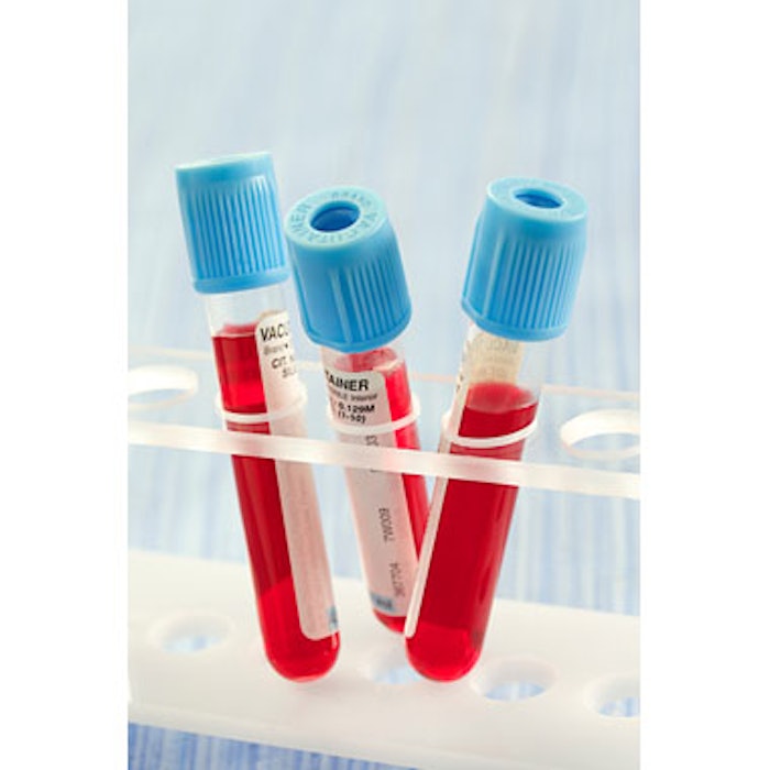 Monthly Lab Tests May Not Be Necessary During Isotretinoin Therapy