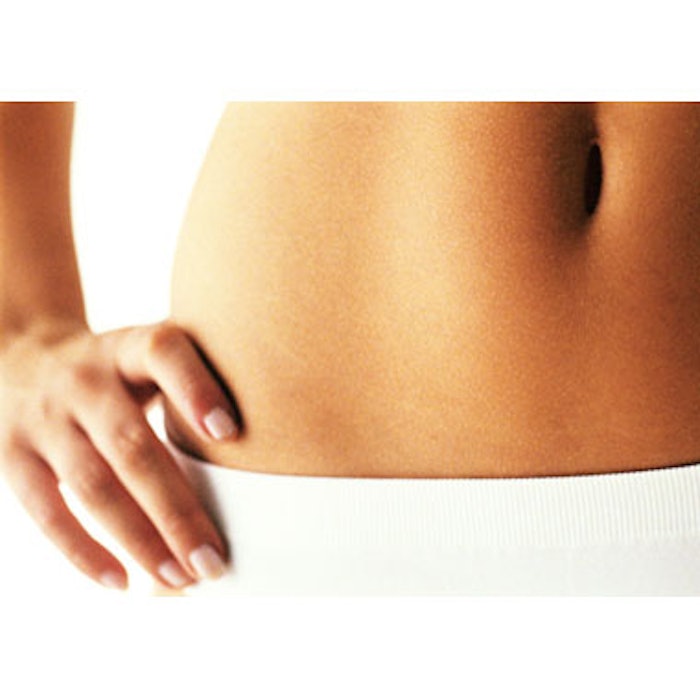 PRP vs. Microdermabrasion for Stretch Marks