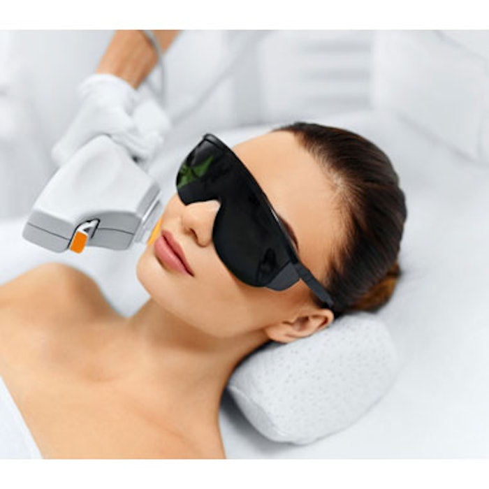 Treating PIH With IPL