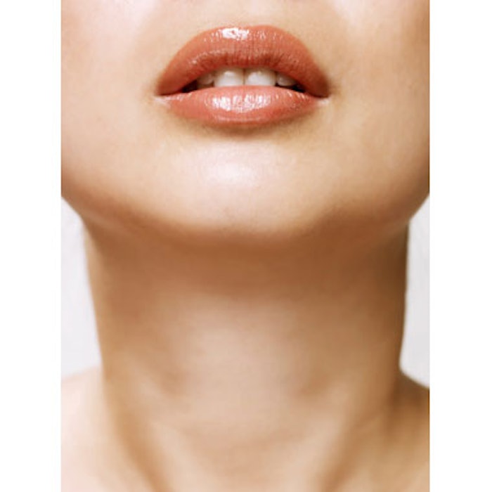 Ultrasound for Neck Laxity