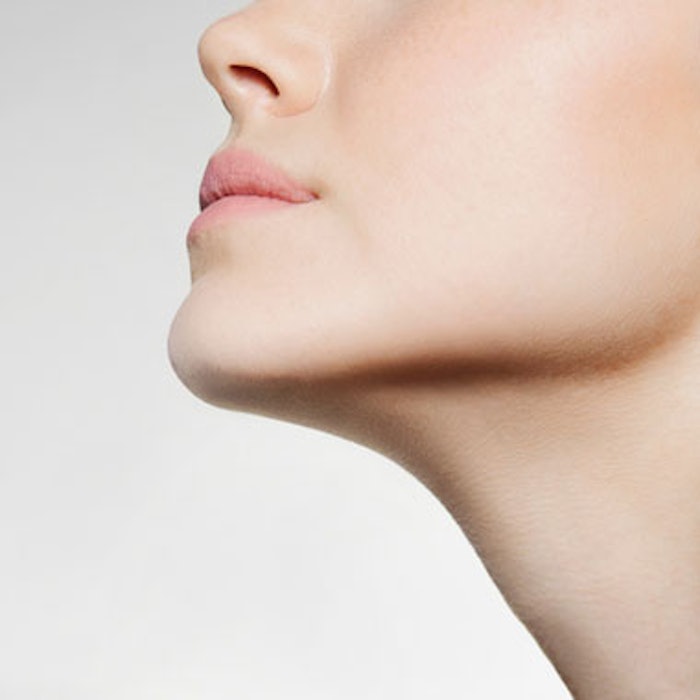 RF + Microneedling Improves Neck Laxity