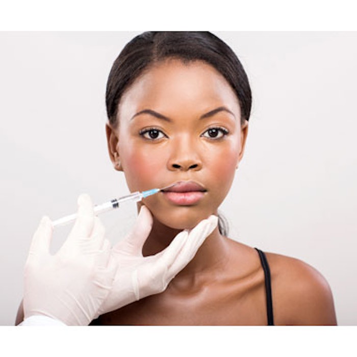 JUVÉDERM VOLBELLA XC Approved for Lips and Perioral Rhytides