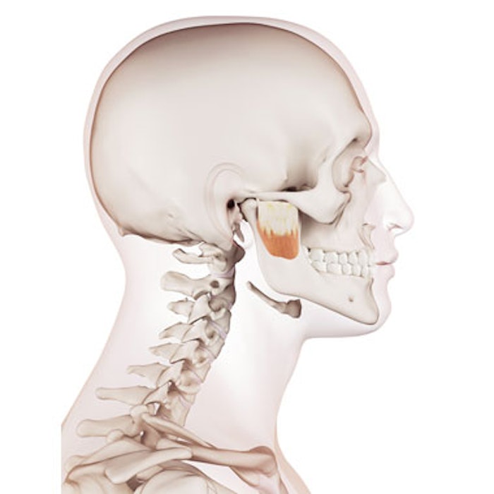 Ultrasound Guidance More Accurate Than Clinical Markings in Masseter Injections