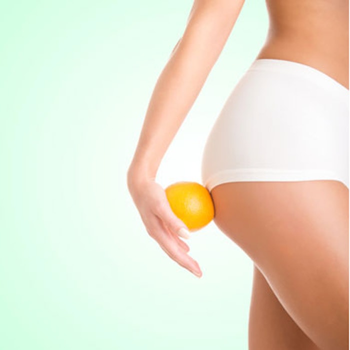 Endo Announces Positive Data from Study of CCH for Cellulite