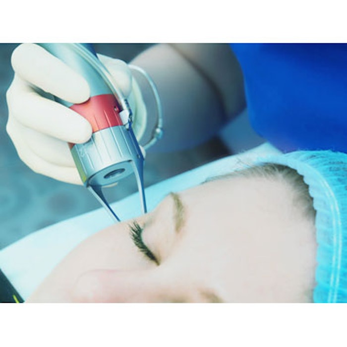 Energy-Based Treatments Safe After PMMA Injections