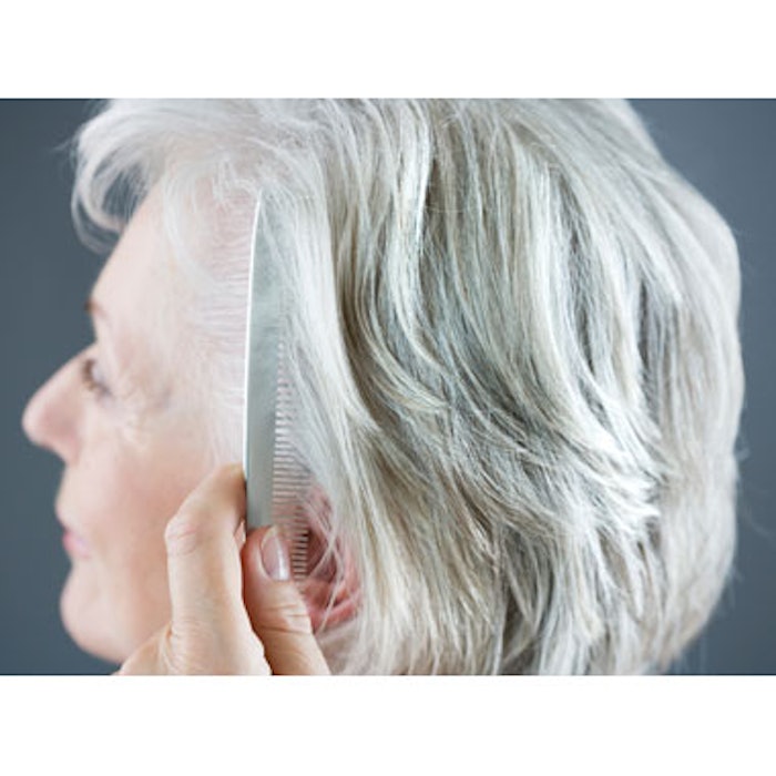 PRP for Alopecia