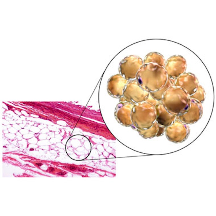 Magnified fat cells