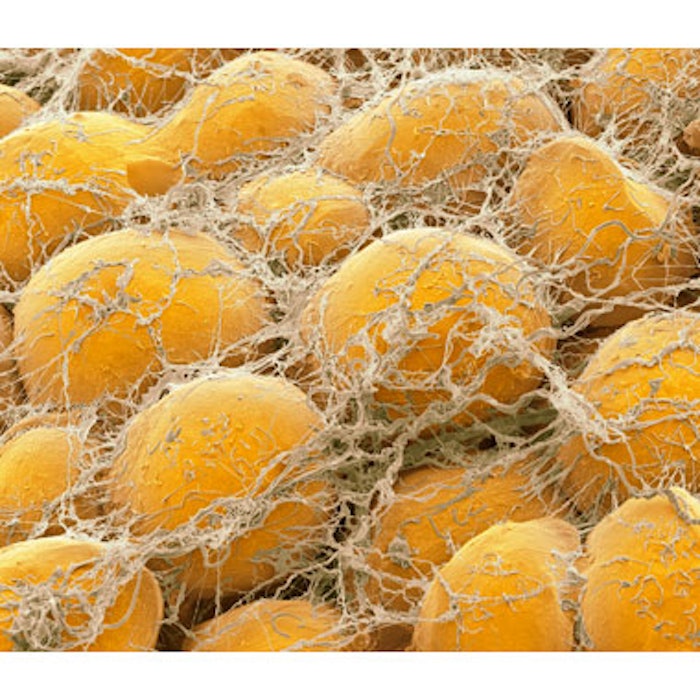 Human Adipose Cells