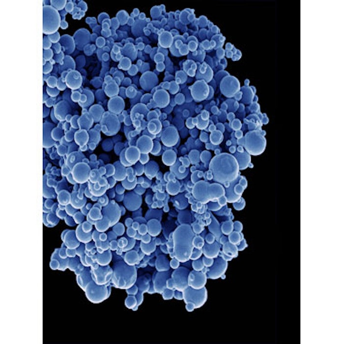 Liposomes