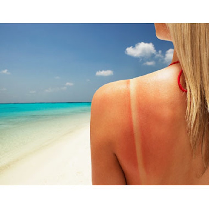 Abnormal eating habits make skin more susceptible to UV damage