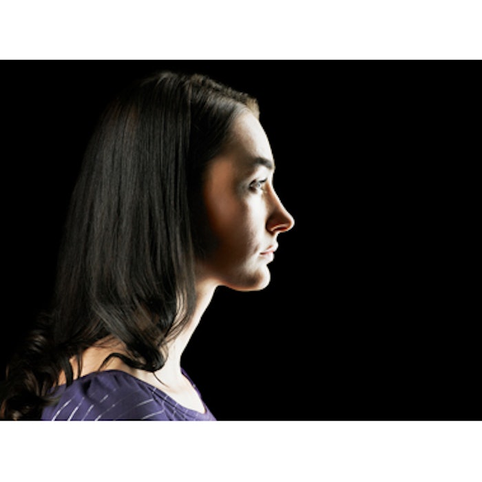 Fat grafting in place of implants for chin augmentation