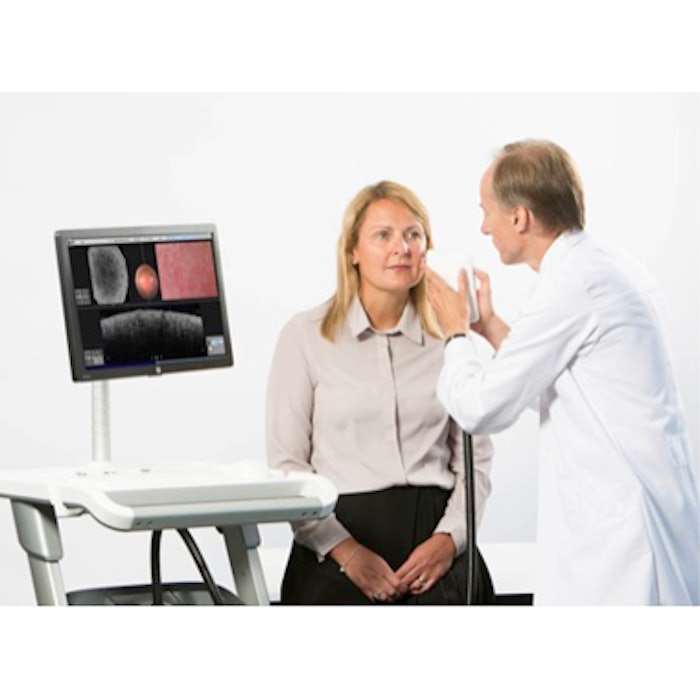 Vivosight OTC