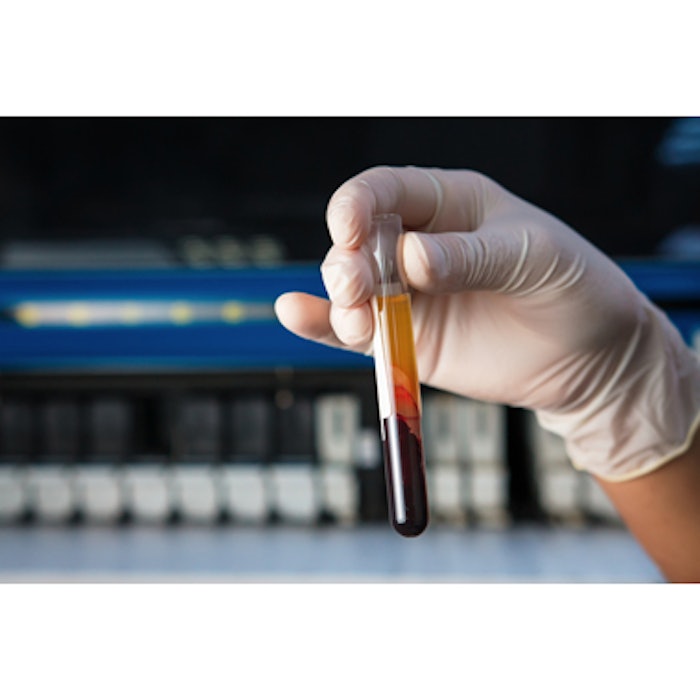 Platelet-Rich Plasma