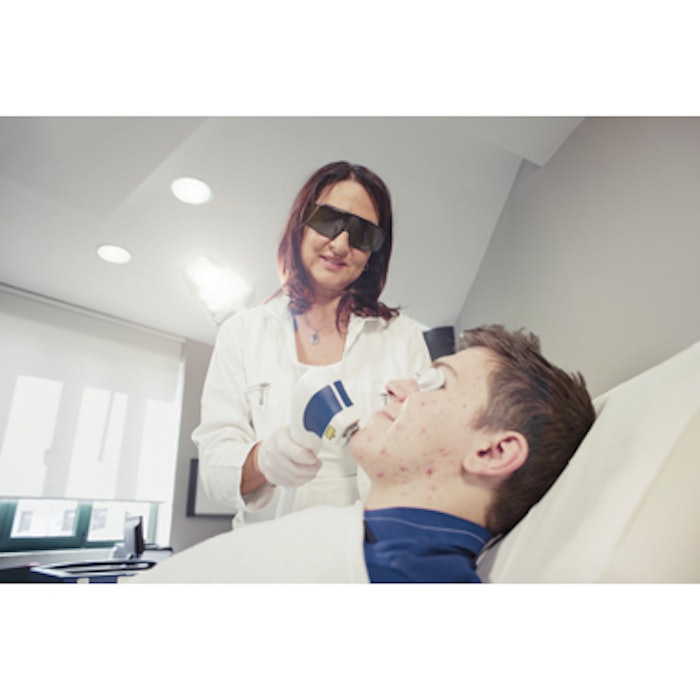 Patient Undergoing Acne Scar Treatment