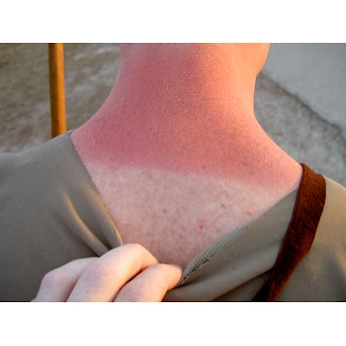 Higher SPF Offers Added Protection