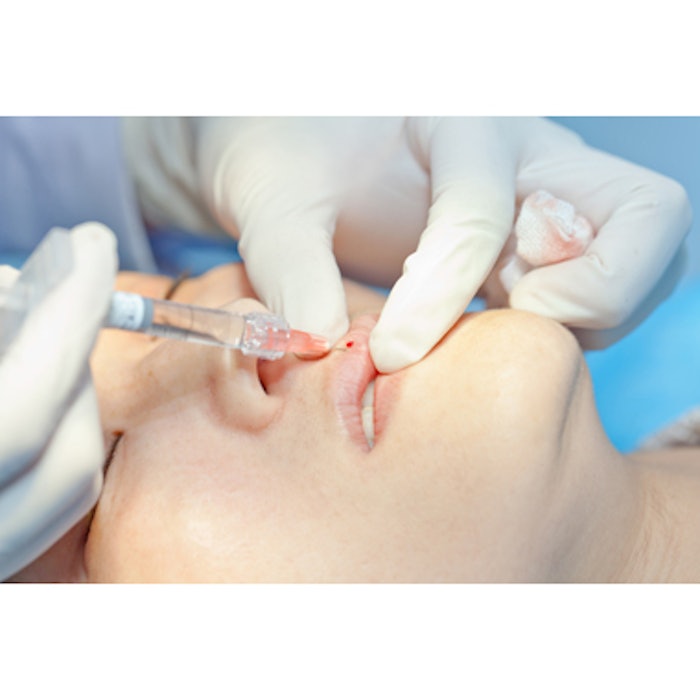Treating HA Filler-Related Nodules