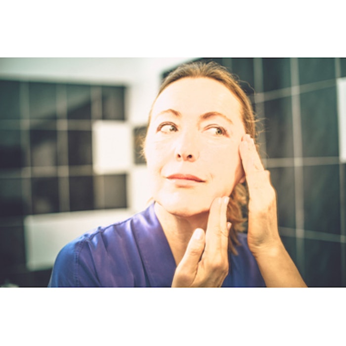 PDL Offers Long-Term Relief of Rosacea Symptoms