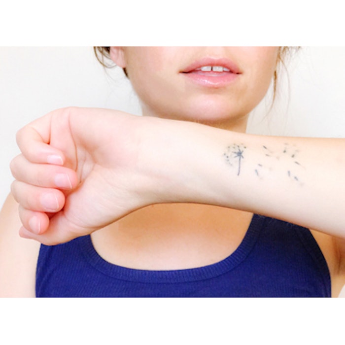 Zwave Improves Laser Tattoo Removal Outcomes