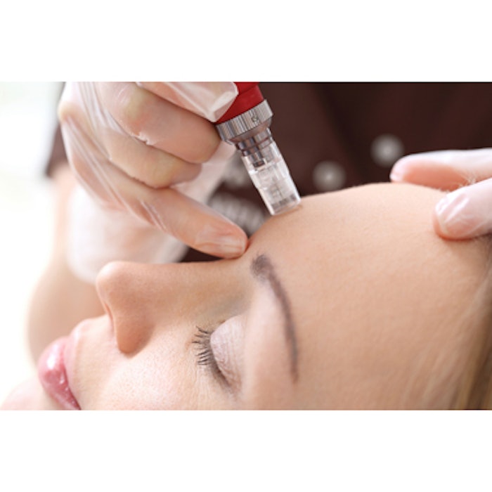 Microneedling Effective With Low Risk