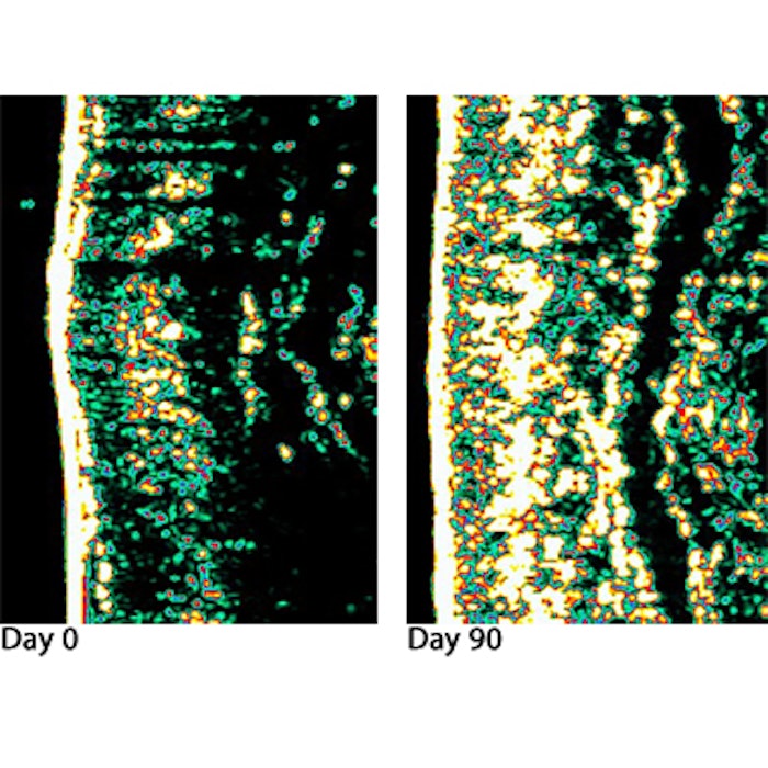 Skin imaging after 90 days of skinade