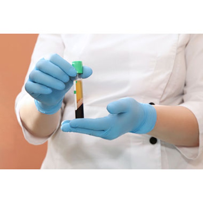 Platelet-Rich Plasma
