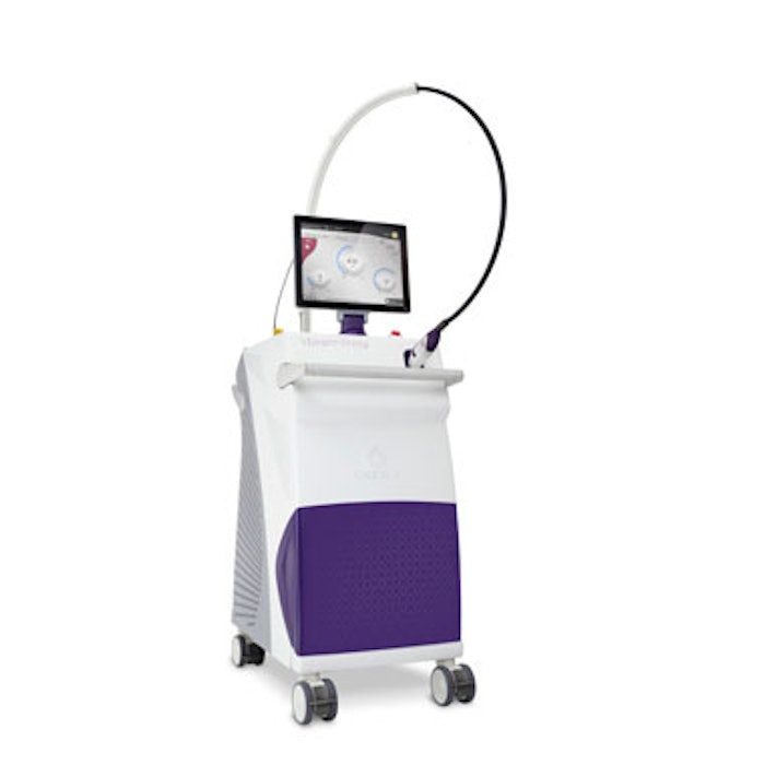 VBeam Prima