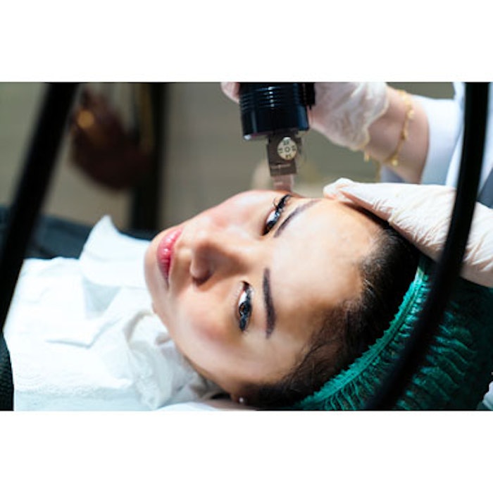 RF Microneedle Treatment