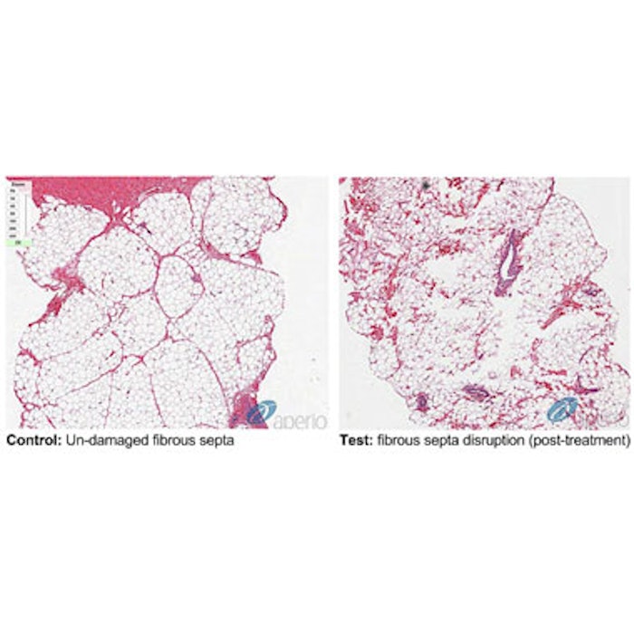 Effect of RAP on Tissue