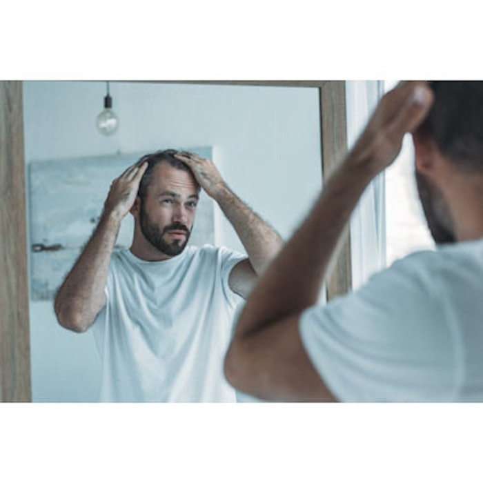 Man with Hair Loss