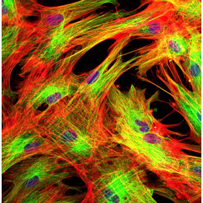 Fibroblasts