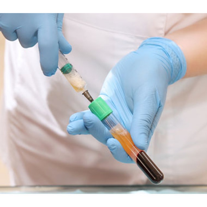 Platelet-Rich Plasma