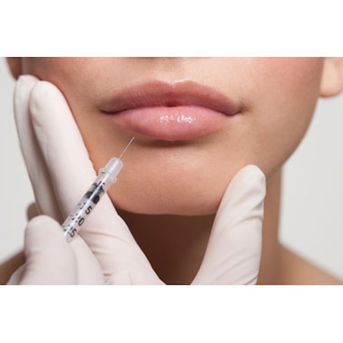 Natural Looking Lip Augmentation
