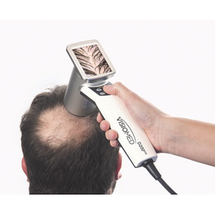 HairMetrix