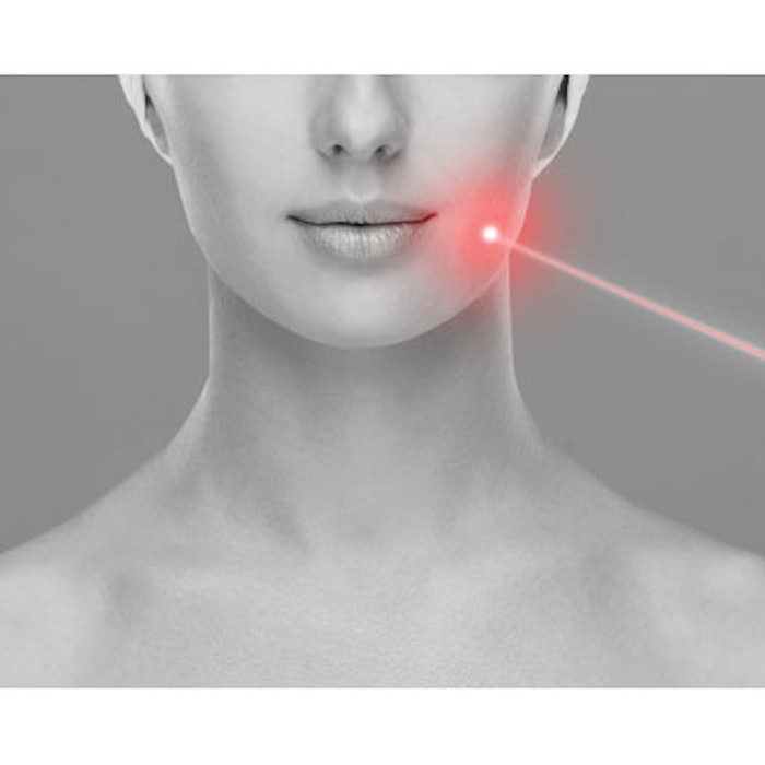 Best Lasers for Unwanted Pigment