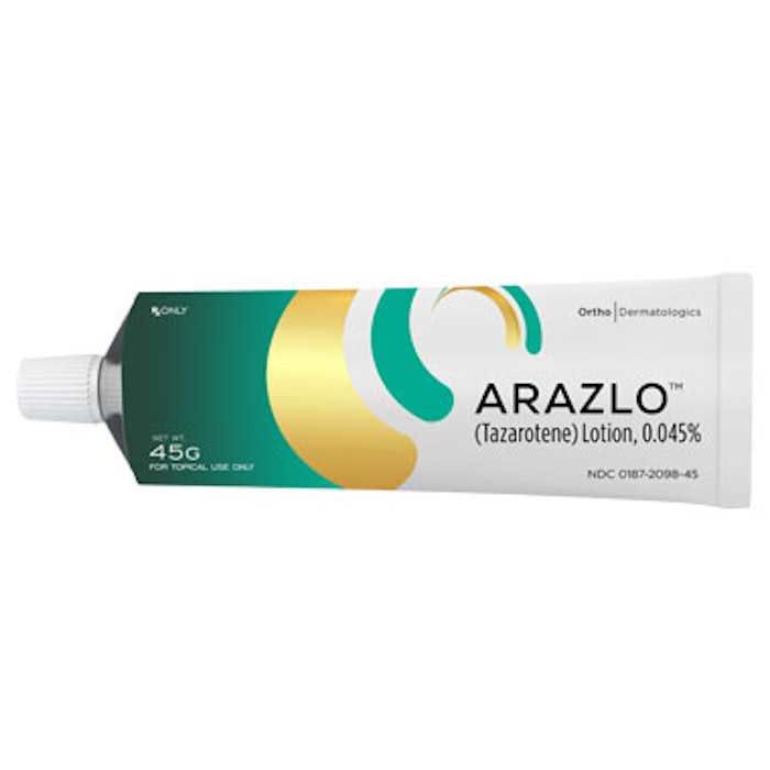 ARAZLO Lotion for Acne