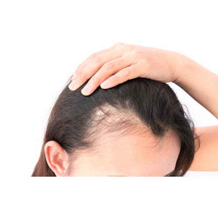 Spironolactone Effective in Reversing Female Hair Loss MedEsthetics