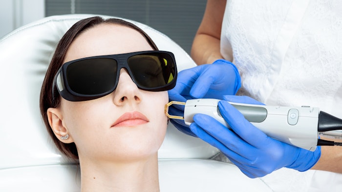 Pulsed Dye Laser study
