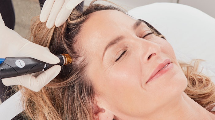 Hydra Facial Keravive Treatment 3