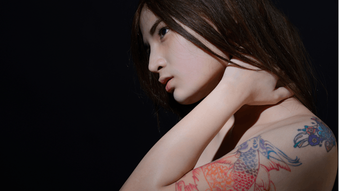 Picosecond laser for tattoo removal