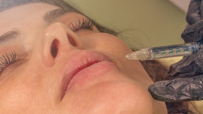 Labial artery location and lip augmentation