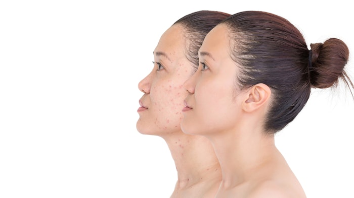 Woman with pigmented skin